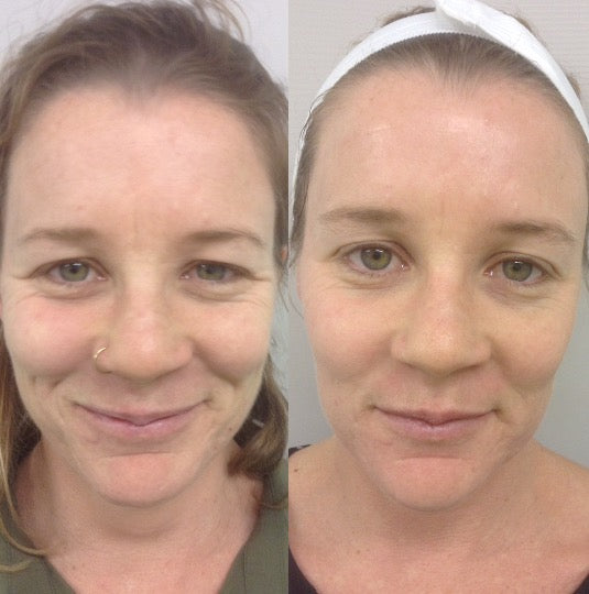 Powerful Muscle Massager - Amazing Grace Alignment